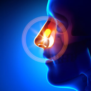 Is-a-Balloon-Sinuplasty-a-Solution-for-Me-300x300