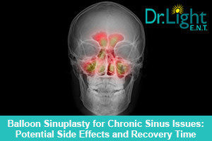 LightMD-Balloon-Sinuplasty-for-Chronic-Sinus-Issues-Potential-Side-Effects-and-Recovery-Time-300x200