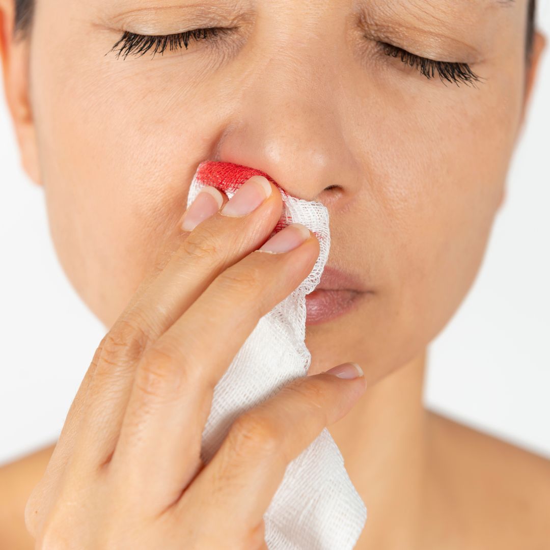 gauze for nosebleed