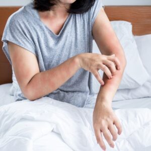 rash on arm