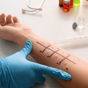 allergy testing
